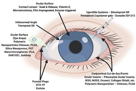 CRSToday | Ophthalmic Drug Delivery