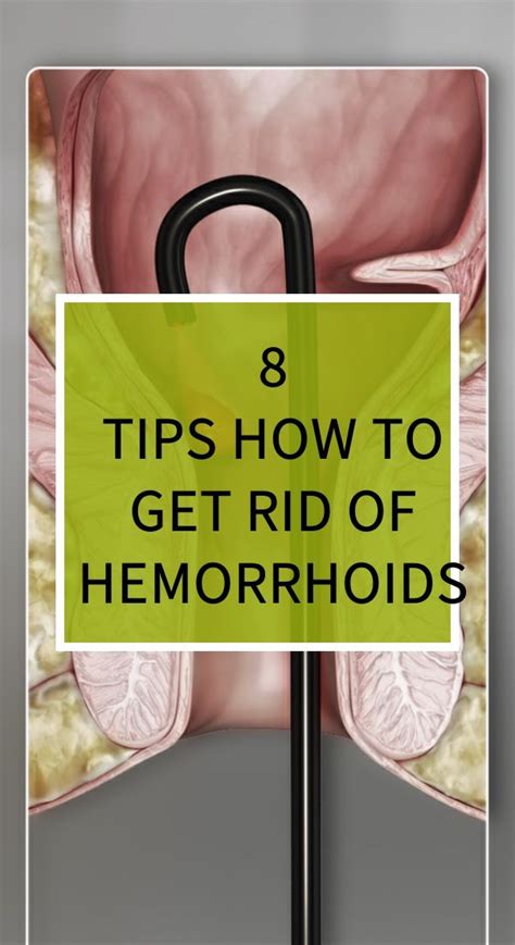 Hemorrhoid Treatment Home Remedy