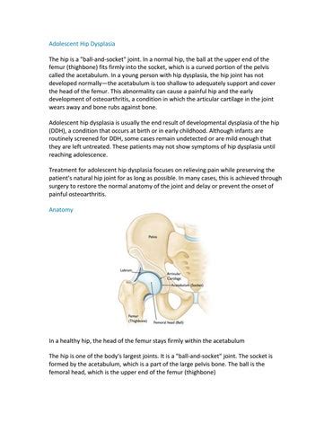 Hip Osteotomy Surgery pdf | Shri Ramchandra Joint Relacement Centre in ...