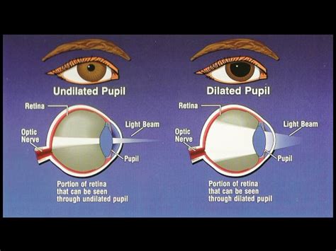 Mydriasis - Causes, Symptoms And Treatment