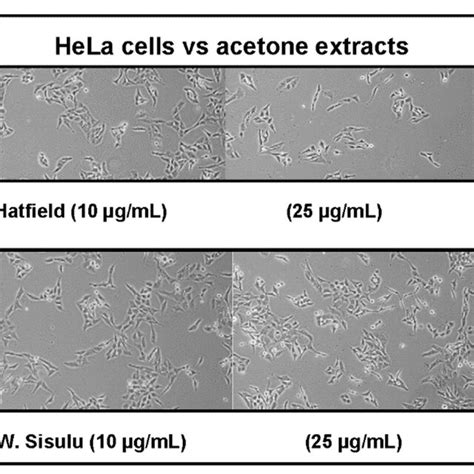 Morphological characterization of HeLa cell line treated with 10 and 25... | Download Scientific ...