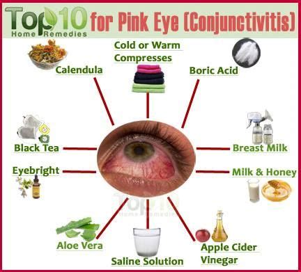 eye care | Pinkeye remedies, Pink eyes, Home remedies