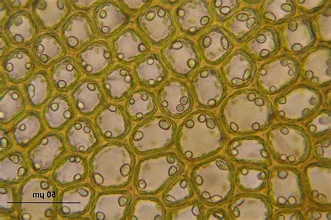 barbilophozia floerkei, cells, liverwort, microscopic, macro, biology, science | Pikist