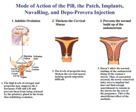 natural abortion methods - DriverLayer Search Engine