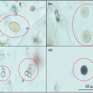 Examples of mold spores recognized under a light microscope. Samples... | Download Scientific ...