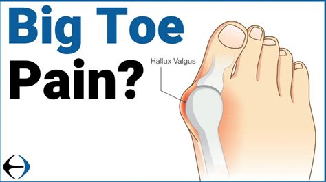 Why does your big toe hurt? - Evercore - Move With a Strong, Healthy Body