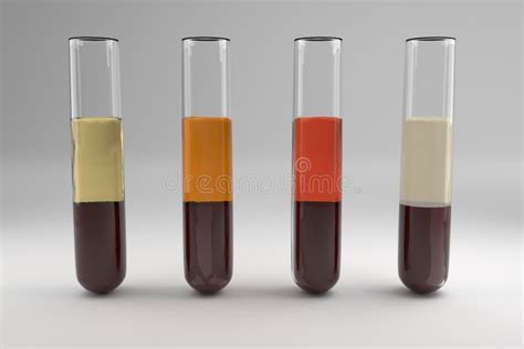 Blood serum common types stock illustration. Illustration of jaundice ...