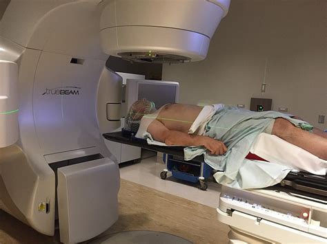 Radiotherapy for Cancer: Medicine or Murder?