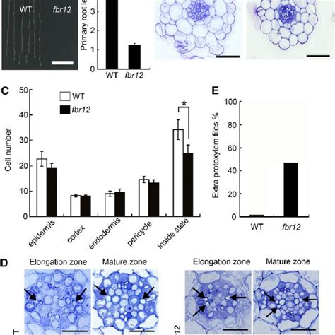 Altered Vascular Development in fbr12 Roots. | Download Scientific Diagram