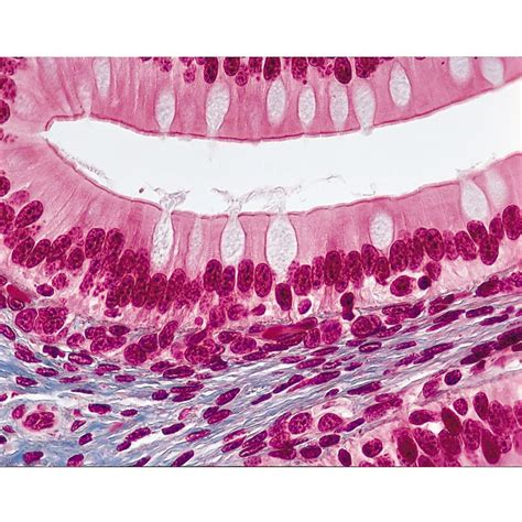 Amphibian Simple Columnar Epithelium, sec. Mallory's - Tobogán para microscopio (7 m) : Amazon ...