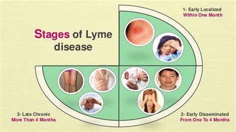 Lyme disease