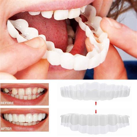 2Pcs Smile Teeth Braces Set Smile Denture Cosmetic Teeth Comfortable ...