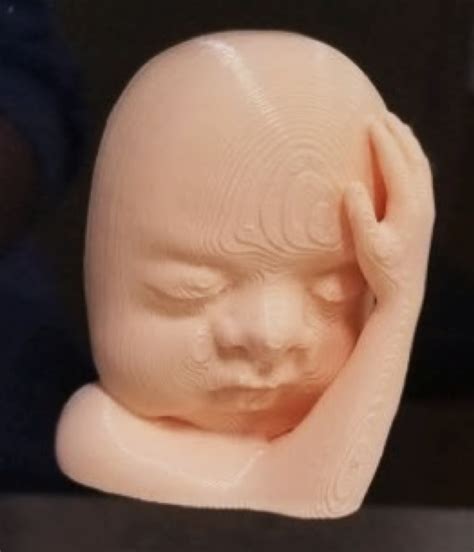 Can ultrasound, 3D printing deepen maternal-fetal bonds?