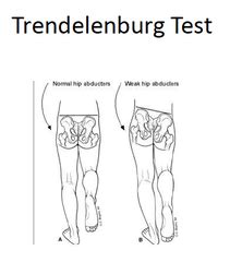 Physical Therapy Special Tests Trendelenburg Test Checks for weak hip ...