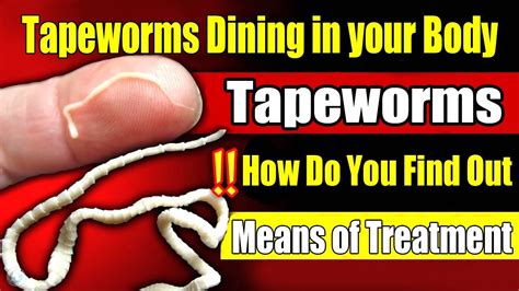 Signs that you have tapeworms living in your body!how do you find out? Means of treatment ...