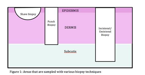 Skin Biopsy