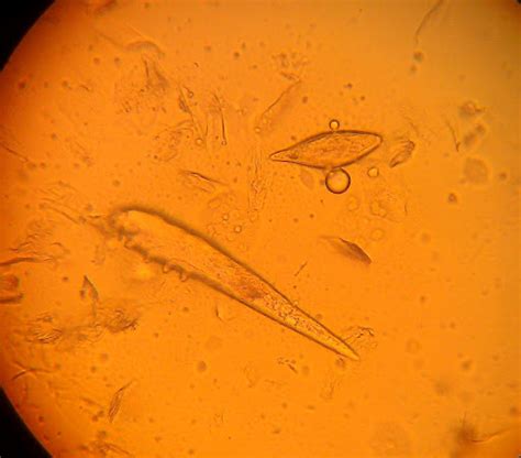 Canine Demodectic Mite - Demodex canis - BugGuide.Net