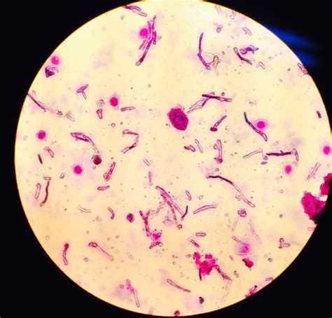 Equine Fungal Eye Ulcer microscope slide 1 - Springhill Equine Veterinary Clinic