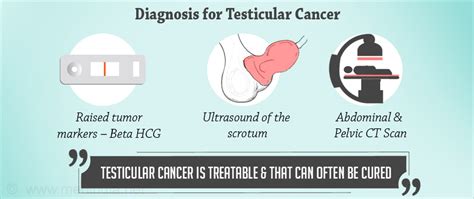 Testicular Cancer - Diagnosis