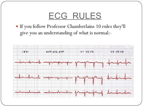 For Dummies: Ecg For Dummies