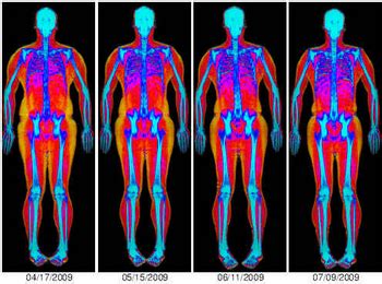 DXA Body Composition & Visceral Fat Testing San Antonio, The Most Complete! | Inside Outside ...