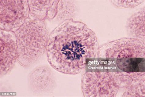 Mitosis Prophase Microscope