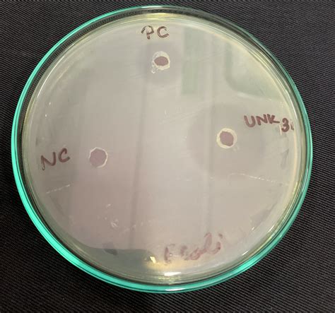 Muller Hinton Agar: Definition, Composition, and 1 Reliable Application - Chemistry Notes