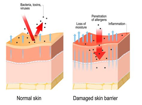 Skin Barrier Repair - Get Healthy Skin With Support From Skincare Experts