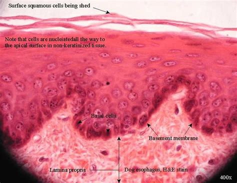 Stratified Squamous Epithelium Non-Keratinized (esophagus) | Histology ...