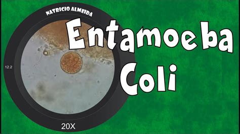 Entamoeba coli - como reconhecer e diferenciar de Entamoeba histolytica - YouTube