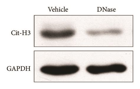 DNase I treatment abolished NET formation in vivo. (a) The DNase I ...