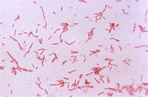 Enterobacter aerogenes antibiotic treatment