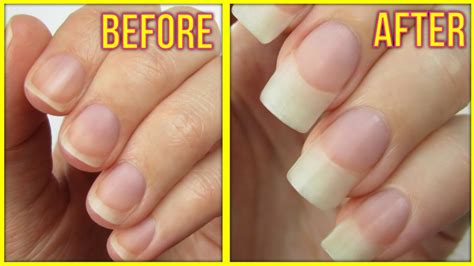 Naturally Grow Your Nails Faster Within A Week | Easy & Effective Home ...