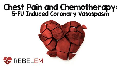 5-FU Induced Coronary Vasospasm - REBEL EM - Emergency Medicine Blog