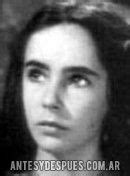 Liz Taylor | Before and After | Photos, Biography and Family