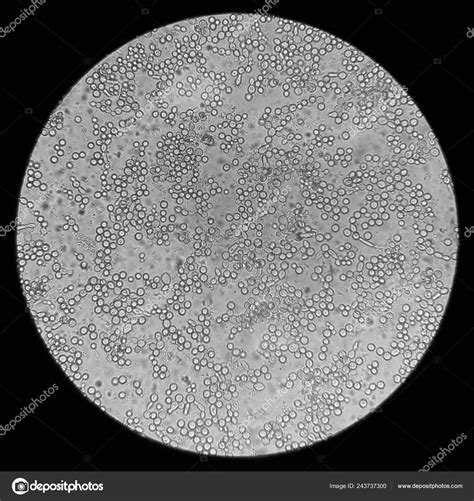 Candidiasis Microscope