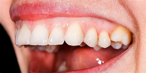 What the Color, Size, Shape, and Feel of Your Gums Say About Your Health | Gum health, Health ...