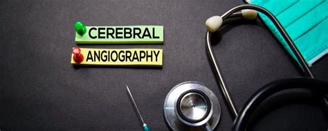 Cerebral angiogram: procedures, preparation and test results - Blog 2024