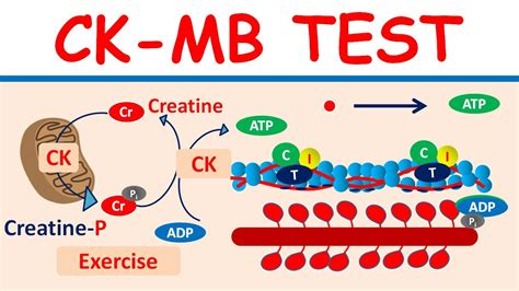 Cardiac Marker:- Part CK-MB (Cardiac Enzyme), 54% OFF