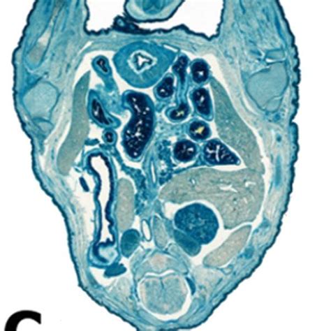 8. LacZ staining in skin of E18 mouse fetus. Lac Staining was present ...