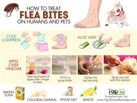 How to Treat Flea Bites on Humans and Pets | Top 10 Home Remedies