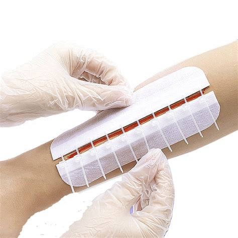 Medical Use Surgical Devices Non-Invasive Adhesive Wound Closure Zipper PU Skin Wound Closure ...