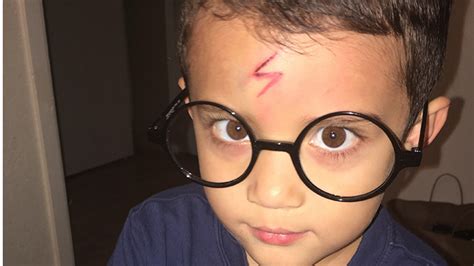 Mom turns self-conscious son's cut into epic Harry Potter scar | Mashable