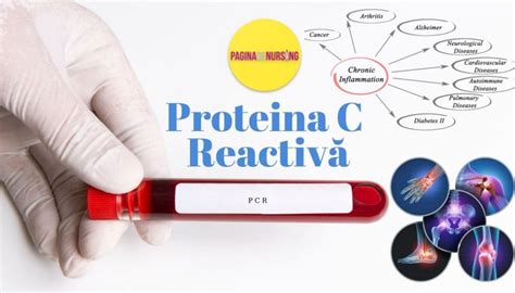 Proteina C reactivă (PCR) – Pagina de Nursing