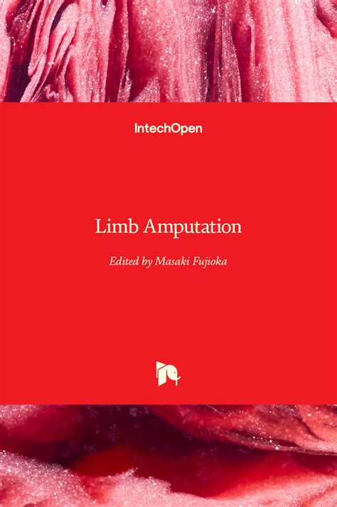 Limb Amputation | IntechOpen