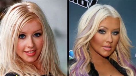 49 Celebrities Before and After Plastic Surgery in 2020 | Celebrities before and after, Plastic ...