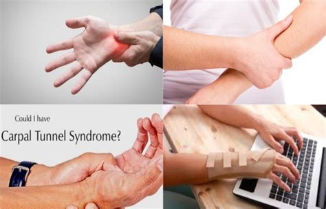 EMG Best Test To Diagnose Carpal Tunnel | Neuro Testing Group - Expert ...