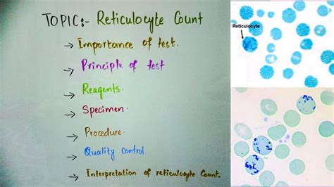 Reticulocyte count principle,procedure and importance in Hindi, Urdu and English. - YouTube