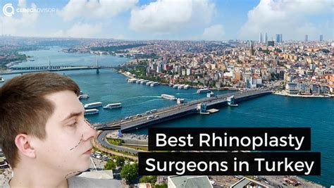 7 Best Rhinoplasty Surgeons in Turkey