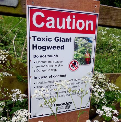 How To Avoid Severe Burns And Blisters From The Giant Hogweed Plant